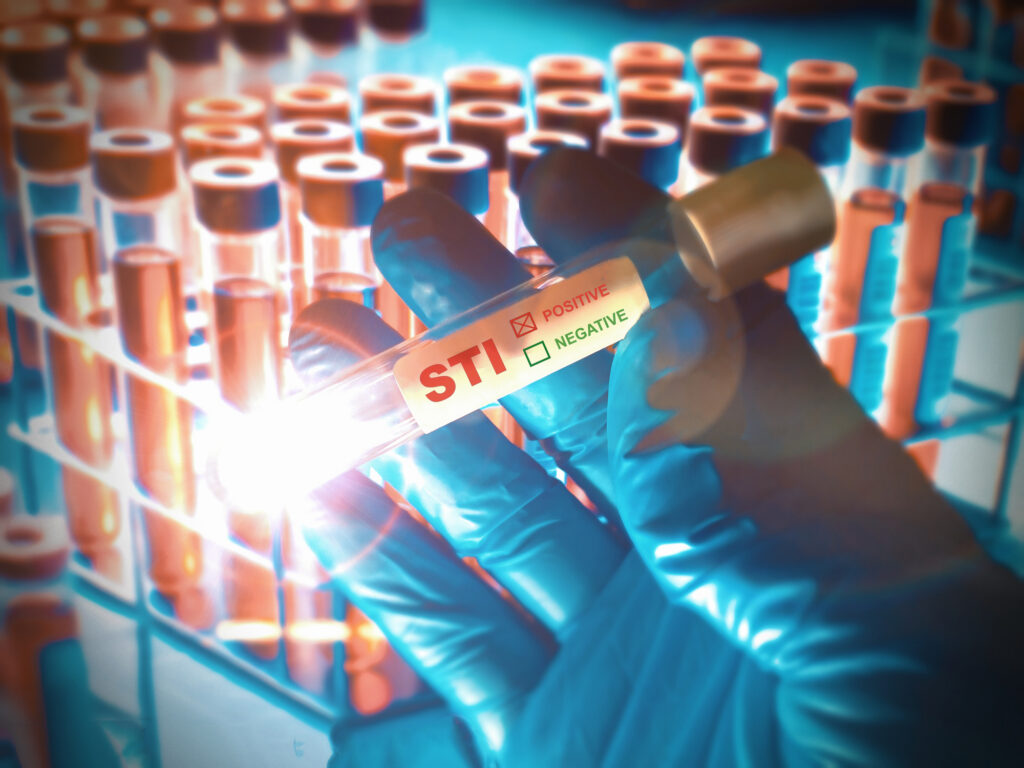 STI rates are down in the US, but testing and treatment are still crucial. Learn why urgent care is the best choice for fast, private STI testing.​​